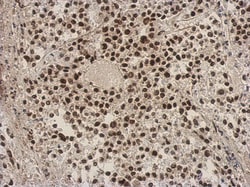 ZNF124 Antibody, Novus Biologicals 0.1mL; Unlabeled:Antibodies, Polyclonal