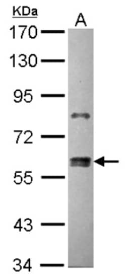 ZNF133 Antibody, Novus Biologicals 0.1mL; Unlabeled:Antibodies, Polyclonal