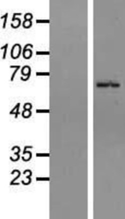 Novus Biologicals™ ZNF133 Overexpression Lysate