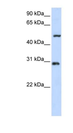 ZNF138 Antibody, Novus Biologicals 100 &mu;L | Buy Online | Novus Biologicals | Fisher Scientific