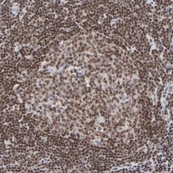 ZNF143 Antibody, Novus Biologicals:Antibodies:Primary Antibodies