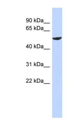 ZNF154 Antibody, Novus Biologicals 100 &mu;L | Buy Online | Novus Biologicals | Fisher Scientific