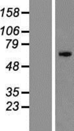 Novus Biologicals&trade;&nbsp;ZNF155 Overexpression Lysate