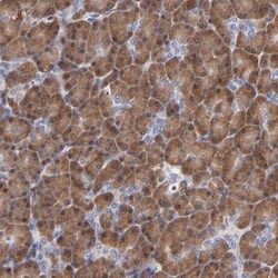 ZNF155 Antibody, Novus Biologicals 25ul | Buy Online | Novus Biologicals | Fisher Scientific