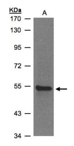ZNF157 Antibody, Novus Biologicals 0.1mL; Unlabeled:Antibodies, Polyclonal