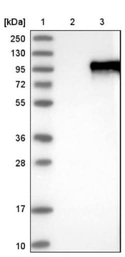 ZNF16 Antibody, Novus Biologicals 25 &mu;L; Unlabeled:Antibodies, Polyclonal