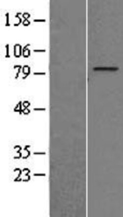 Novus Biologicals&trade;&nbsp;ZNF16 Overexpression Lysate