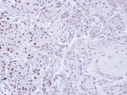 ZNF165 Antibody, Novus Biologicals 100 &mu;L | Buy Online | Novus Biologicals | Fisher Scientific