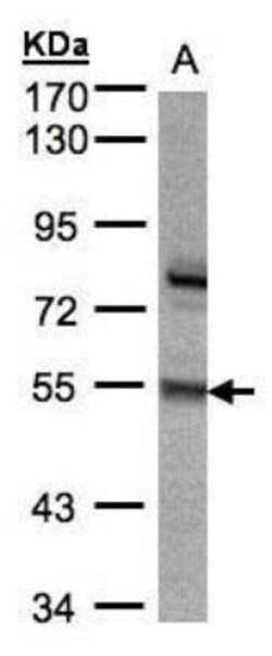 ZNF165 Antibody, Novus Biologicals 100 &mu;L | Buy Online | Novus Biologicals | Fisher Scientific
