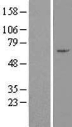Novus Biologicals&trade;&nbsp;ZNF165 Overexpression Lysate