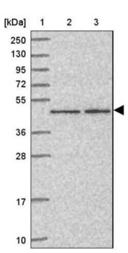ZNF167 Antibody, Novus Biologicals 0.1mL; Unlabeled:Antibodies, Polyclonal