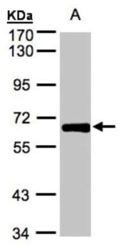 ZNF169 Antibody, Novus Biologicals 0.1mL; Unlabeled:Antibodies, Polyclonal
