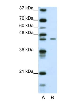 ZNF17 Antibody, Novus Biologicals:Antibodies:Primary Antibodies