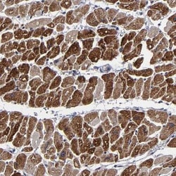 ZNF175 Antibody, Novus Biologicals 25 &mu;L; Unlabeled:Antibodies, Polyclonal