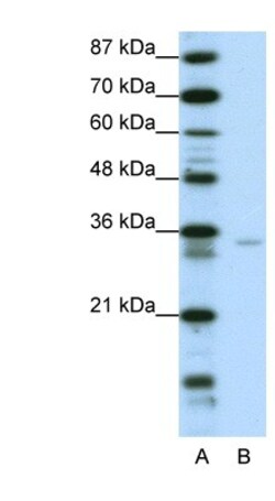 ZNF177 Antibody, Novus Biologicals 20&mu;L; Unlabeled:Antibodies, Polyclonal