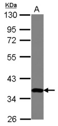 ZNF177 Antibody, Novus Biologicals 0.1 mL | Buy Online | Novus Biologicals | Fisher Scientific