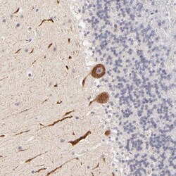 ZNF177 Antibody, Novus Biologicals 25 &mu;L; Unlabeled:Antibodies, Polyclonal
