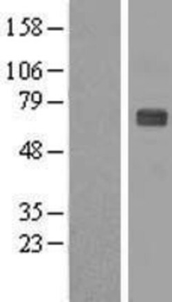 Novus Biologicals&trade;&nbsp;ZNF179 Overexpression Lysate