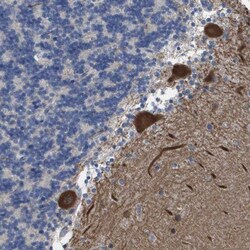 ZNF179 Antibody, Novus Biologicals 0.1mL; Unlabeled:Antibodies, Polyclonal