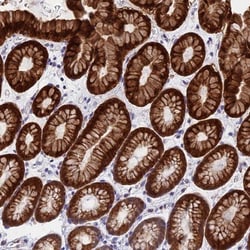 ZNF181 Antibody, Novus Biologicals:Antibodies:Primary Antibodies