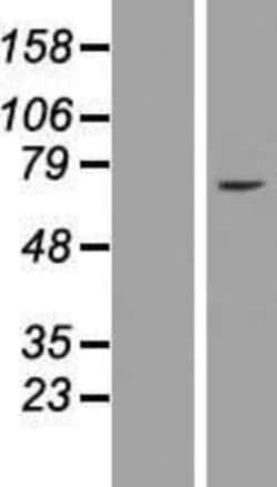 Novus Biologicals&trade;&nbsp;ZNF182 Overexpression Lysate