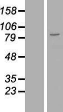 Novus Biologicals&trade;&nbsp;ZNF184 Overexpression Lysate