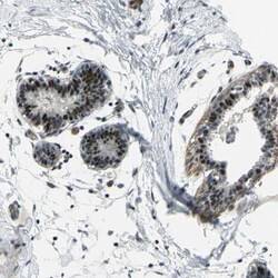 ZNF184 Antibody, Novus Biologicals 0.1mL; Unlabeled:Antibodies, Polyclonal