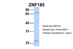 ZNF185 Antibody, Novus Biologicals 20&mu;L; Unlabeled:Antibodies, Polyclonal