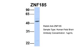 ZNF185 Antibody, Novus Biologicals 20&mu;L; Unlabeled:Antibodies, Polyclonal