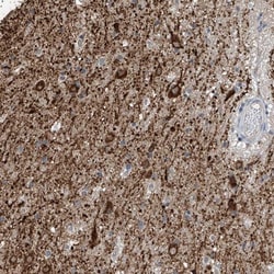 ZNF189 Antibody, Novus Biologicals:Antibodies:Primary Antibodies