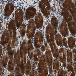 ZNF18 Antibody, Novus Biologicals:Antibodies:Primary Antibodies