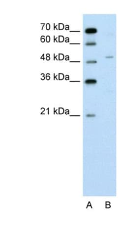 ZNF19 Antibody, Novus Biologicals:Antibodies:Primary Antibodies