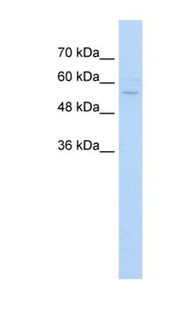 ZNF19 Antibody, Novus Biologicals 100&mu;L; Unlabeled:Antibodies, Polyclonal