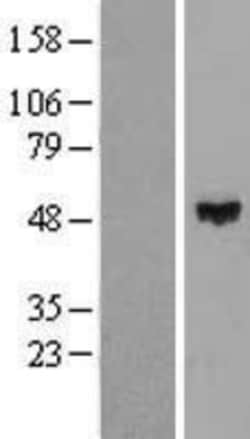 Novus Biologicals&trade;&nbsp;ZNF193 Overexpression Lysate