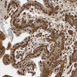 ZNF195 Antibody, Novus Biologicals 0.1mL; Unlabeled:Antibodies, Polyclonal