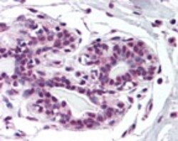 ZNF198 Antibody, Novus Biologicals:Antibodies:Primary Antibodies