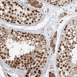 ZNF198 Antibody, Novus Biologicals:Antibodies:Primary Antibodies