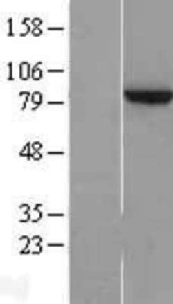 Novus Biologicals™ ZNF202 Overexpression Lysate