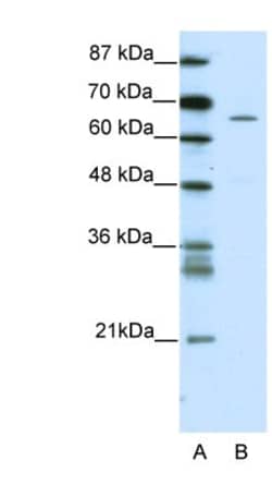 ZNF205 Antibody, Novus Biologicals 100 &mu;L | Buy Online | Novus Biologicals | Fisher Scientific
