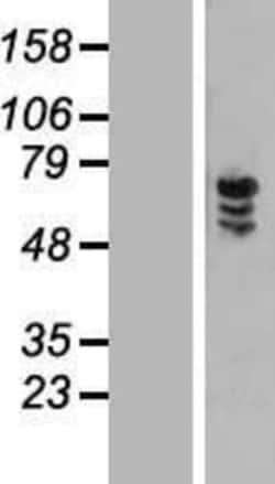 Novus Biologicals&trade;&nbsp;ZNF205 Overexpression Lysate