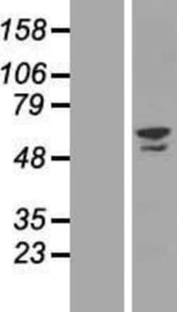 Novus Biologicals&trade;&nbsp;ZNF212 Overexpression Lysate