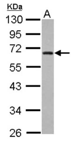 ZNF215 Antibody, Novus Biologicals 0.1mL; Unlabeled:Antibodies, Polyclonal