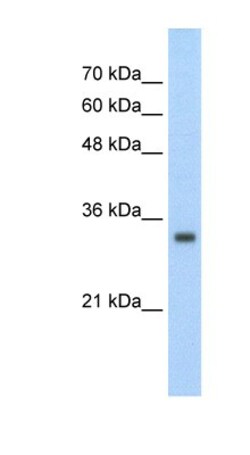 ZNF227 Antibody, Novus Biologicals:Antibodies:Primary Antibodies