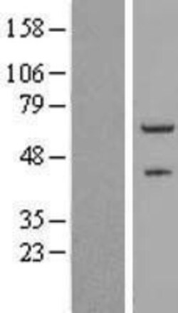Novus Biologicals&trade;&nbsp;ZNF232 Overexpression Lysate
