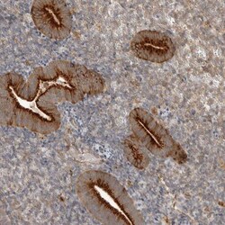 ZNF232 Antibody, Novus Biologicals 25 &mu;L | Buy Online | Novus Biologicals | Fisher Scientific