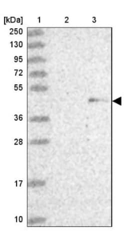 ZNF239 Antibody, Novus Biologicals 0.1mL; Unlabeled:Antibodies, Polyclonal