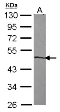 ZNF239 Antibody, Novus Biologicals 0.1mL; Unlabeled:Antibodies, Polyclonal