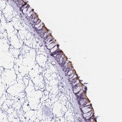 ZNF239 Antibody, Novus Biologicals 0.1mL; Unlabeled:Antibodies, Polyclonal
