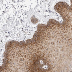 ZNF23 Antibody, Novus Biologicals 25 &mu;L; Unlabeled:Antibodies, Polyclonal