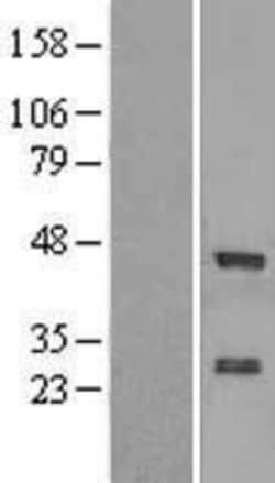 Novus Biologicals&trade;&nbsp;ZNF24 Overexpression Lysate